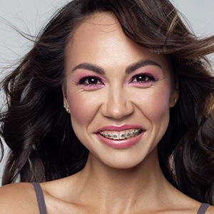 Portrait of smiling adult woman with braces