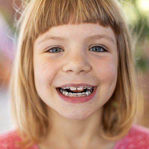 Smiling young girl receiving dentofacial orthopedics treatment