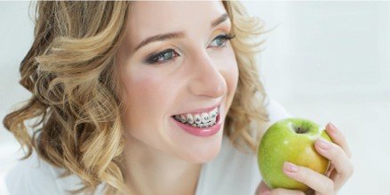Woman with braces eating an apple with peel stuck between teeth