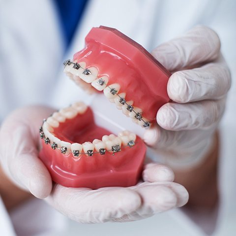 Dental braces mold in Grayslake