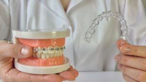 Orthodontic professional holding clear aligner and braces model 